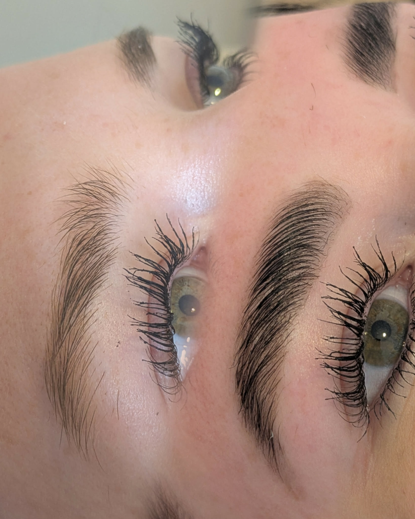 Beauty treatment 02
