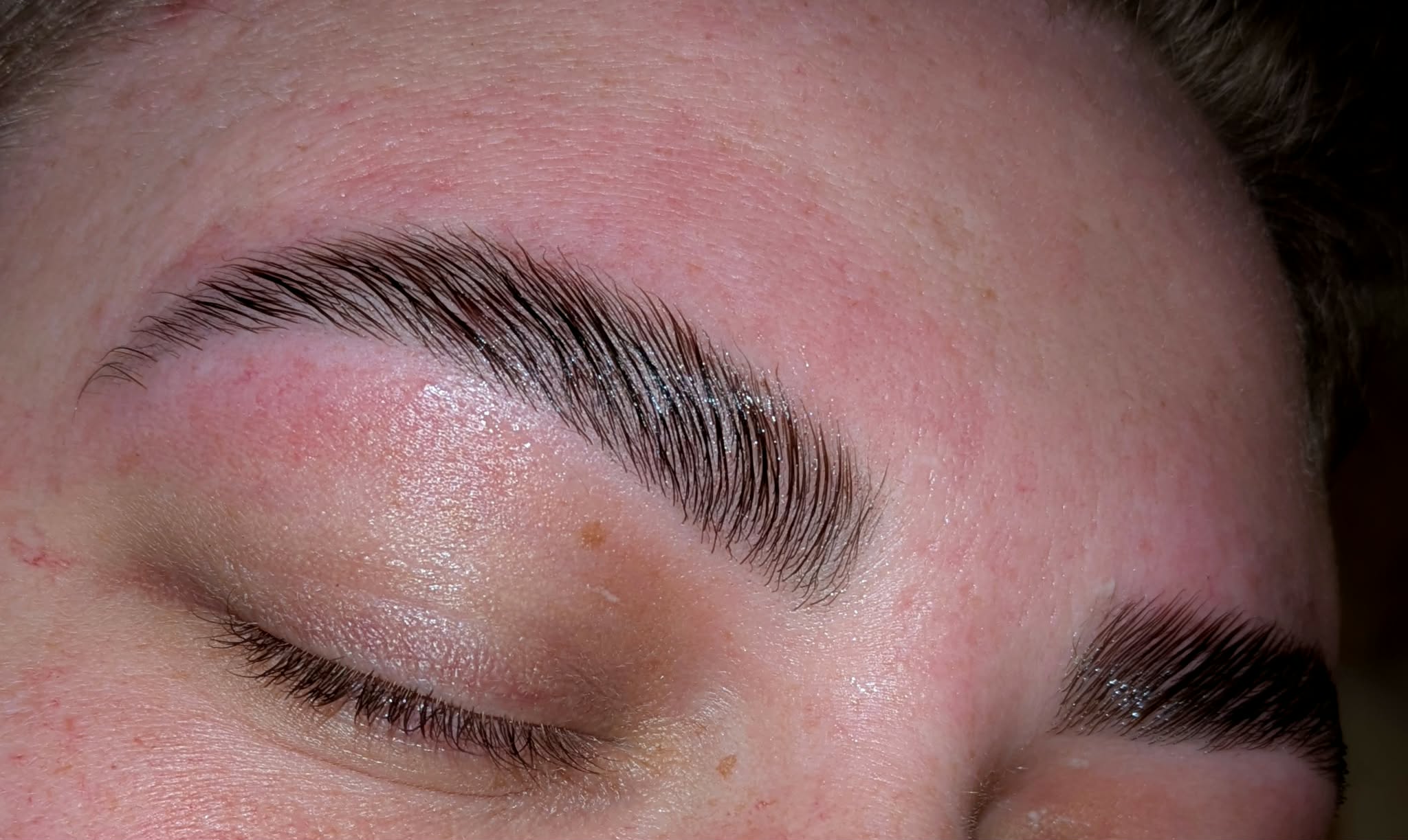 Beauty treatment 03