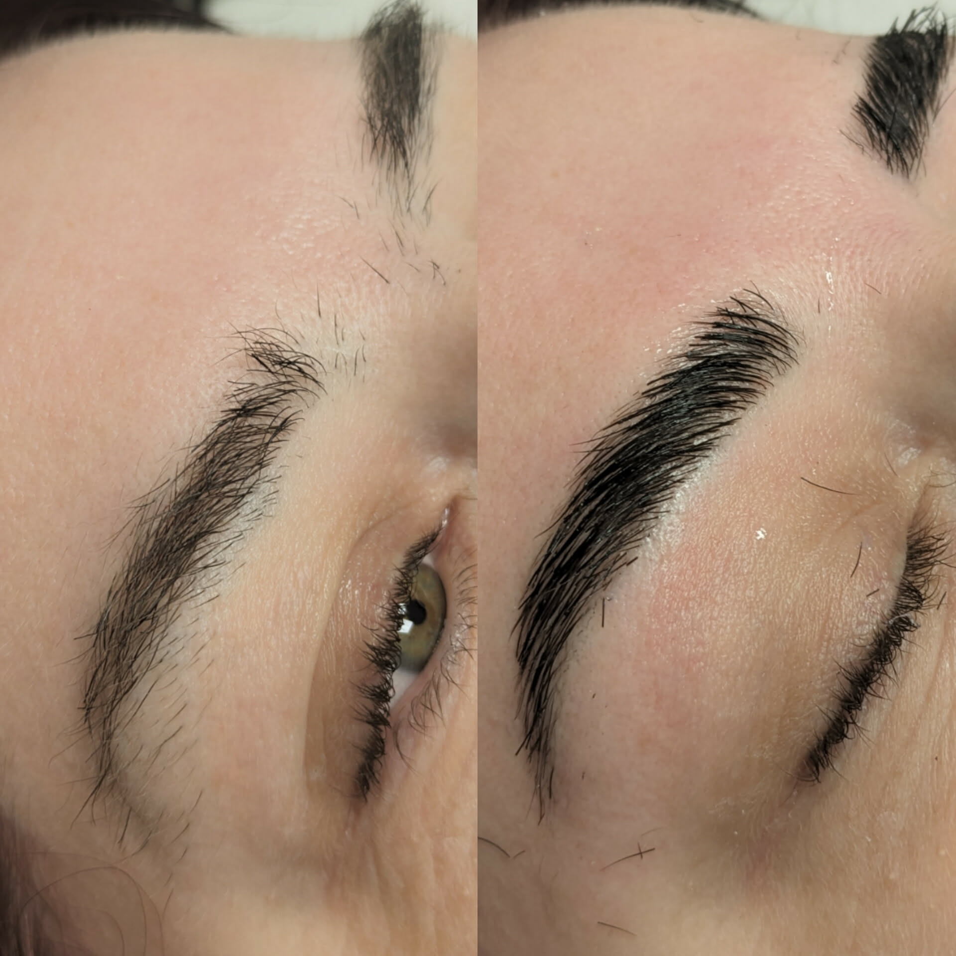 Beauty treatment 04