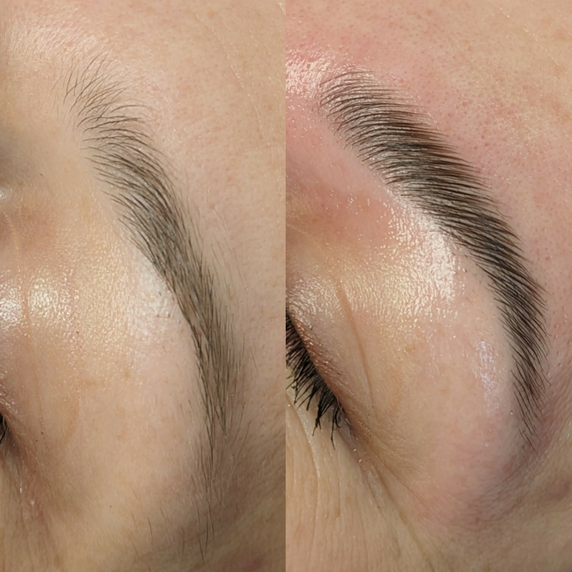 Beauty treatment 06