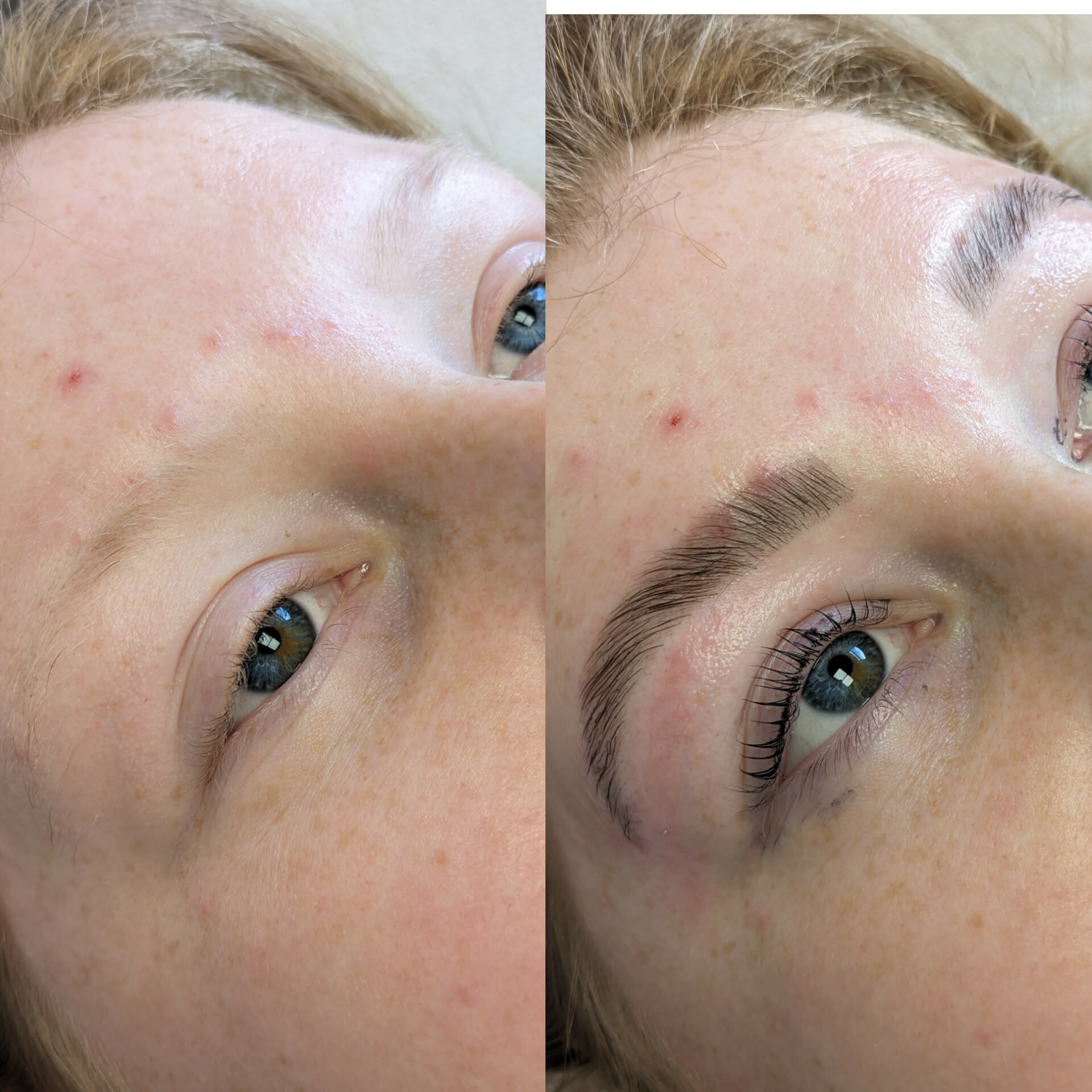 Beauty treatment 08