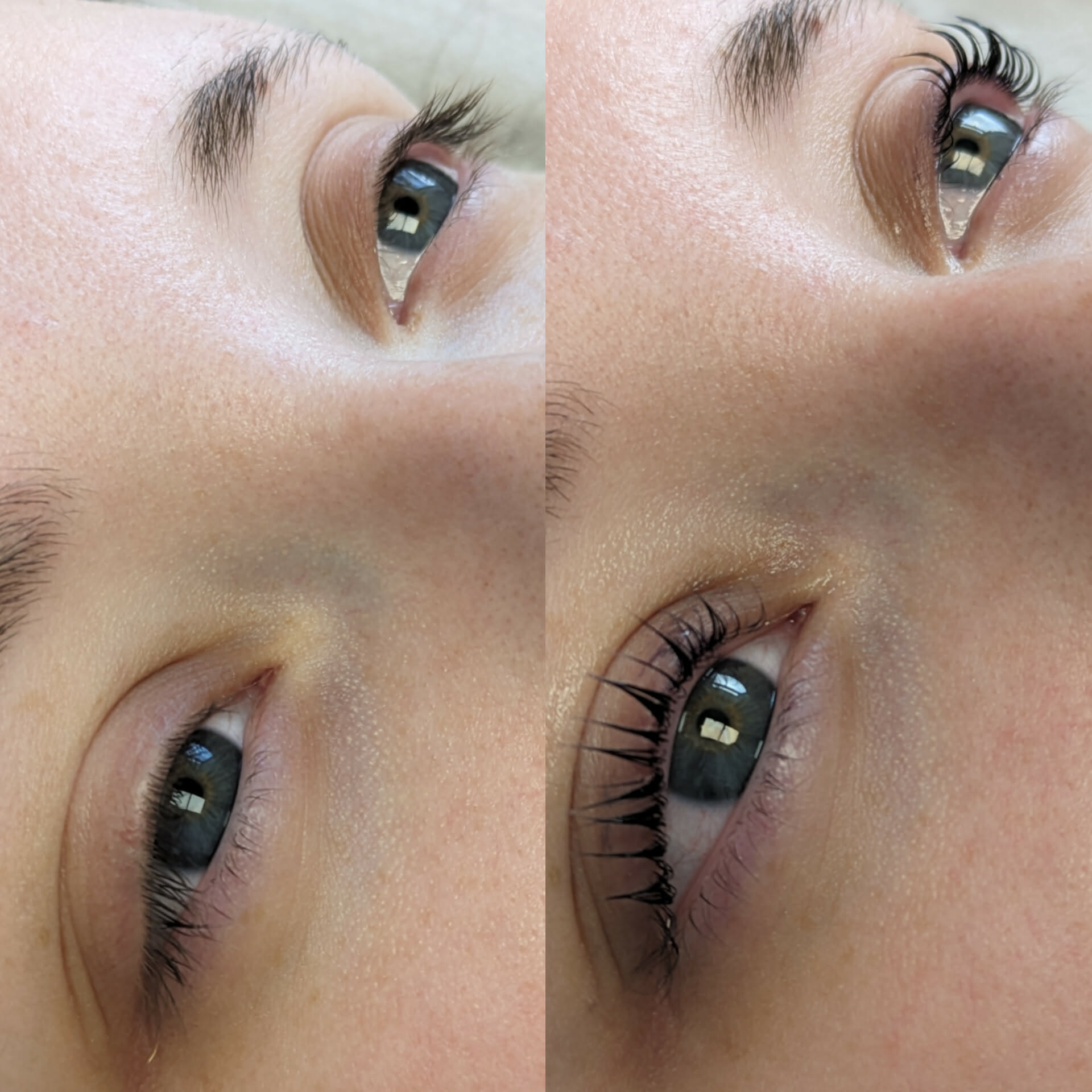 Beauty treatment 11
