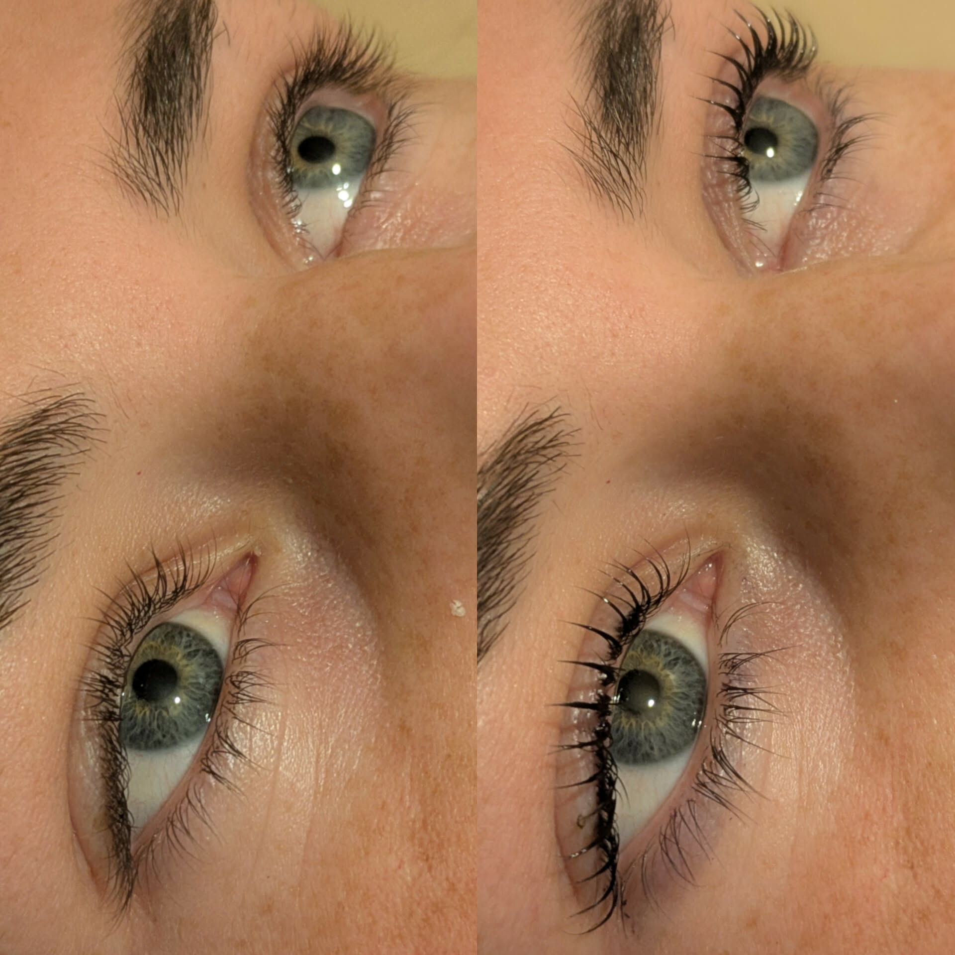 Beauty treatment 12