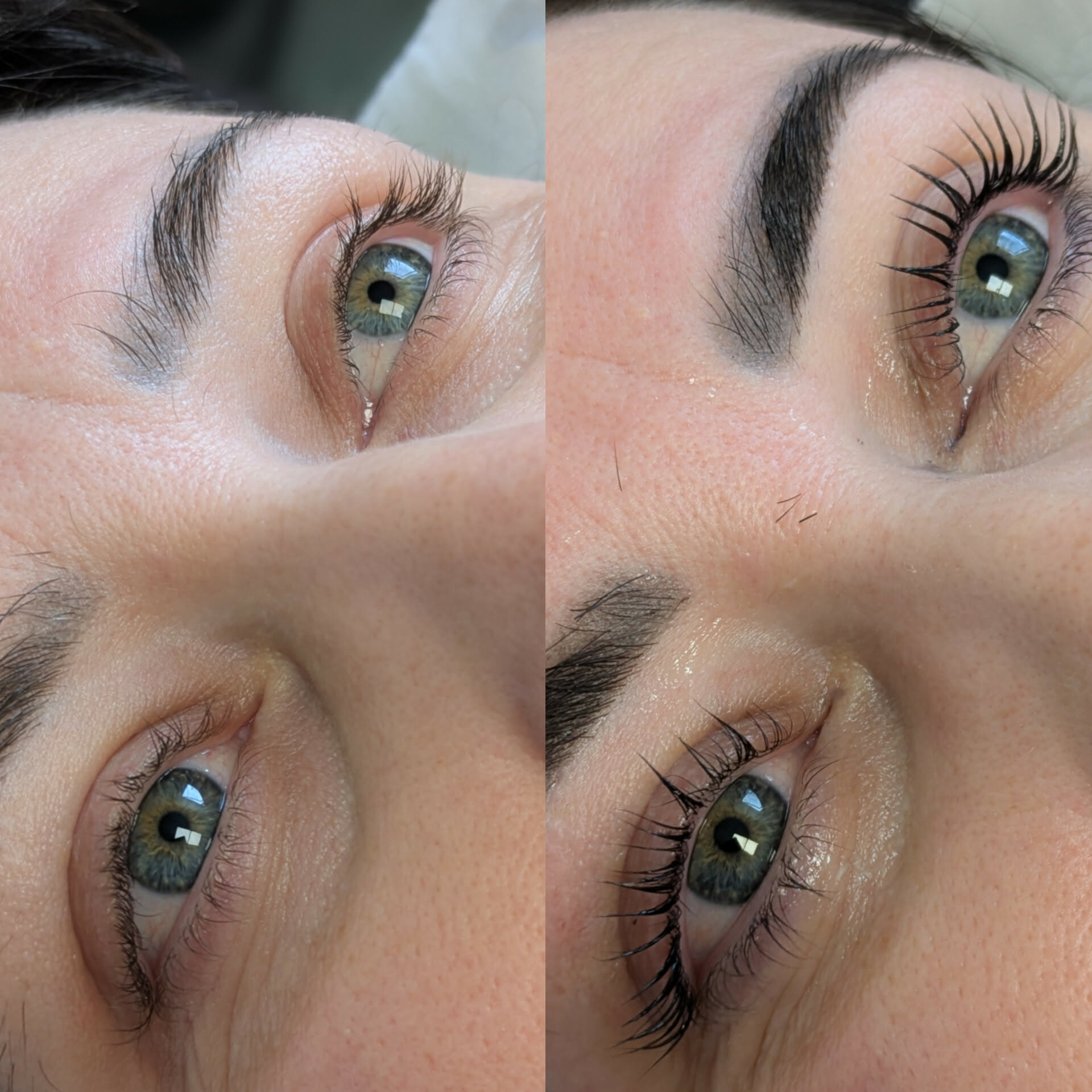 Beauty treatment 13