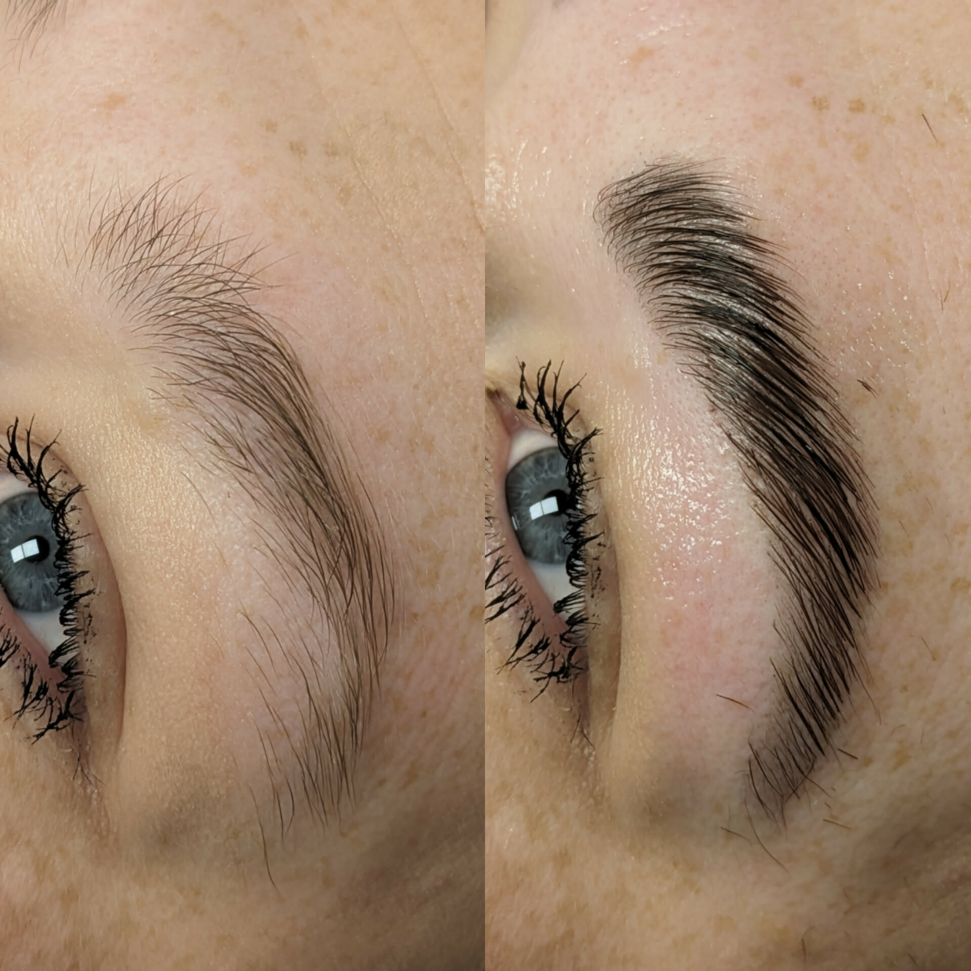Beauty treatment 14