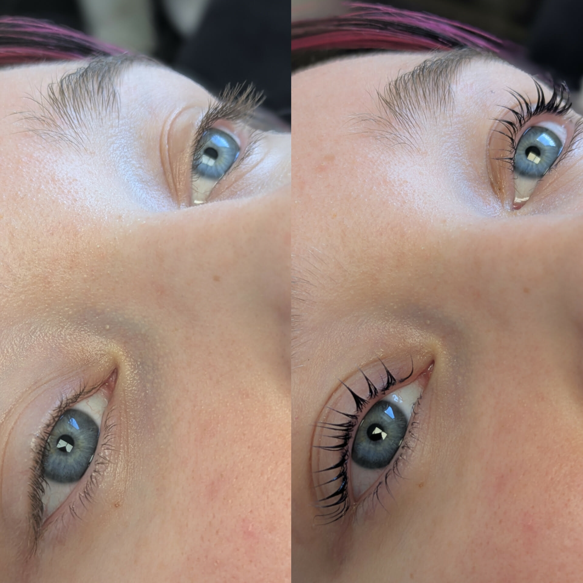 Beauty treatment 15